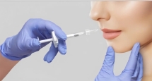 FILLER: MÓN HỜI LÀM ĐẸP HAY RỦI RO TIỀM ẨN
